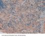Tumor Necrosis Factor Receptor Superfamily Member 1B / CD120b (TNFRSF1B) Antibody