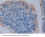 Angiotensin I Converting Enzyme 2 Antibody