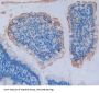 Angiotensin I Converting Enzyme 2 Antibody