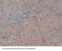 Leukocyte Elastase Inhibitor (SERPINB1) Antibody