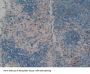 Leukocyte Elastase Inhibitor (SERPINB1) Antibody