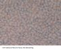 Leukocyte Elastase Inhibitor (SERPINB1) Antibody