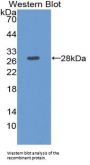 Delta Like 1 Homolog (dLK1) Antibody