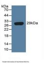 Interferon-Induced GTP-Binding Protein Mx1 (MX1) Antibody