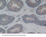 Podocalyxin (PODXL) Antibody