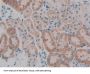 Gastric Inhibitory Polypeptide (GIP) Antibody