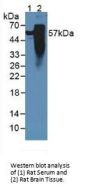 Microtubule-Associated Protein Tau (MAPT) Antibody