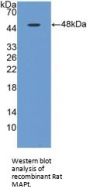 Microtubule-Associated Protein Tau (MAPT) Antibody