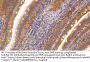 Lipoprotein Lipase (LPL) Antibody