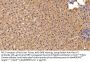 Lipoprotein Lipase (LPL) Antibody