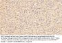 Lipoprotein Lipase (LPL) Antibody