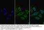 Lipoprotein Lipase (LPL) Antibody
