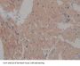 Intercellular Adhesion Molecule 2 / CD102 (ICAM2) Antibody