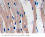 Programmed Cell Death 1 Ligand 1 (CD274) Antibody