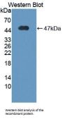 Vitronectin (VTN) Antibody