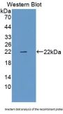 Relaxin (RLN) Antibody