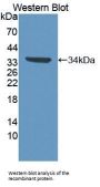 Complement Component 1, Q Receptor (C1qR1) Antibody