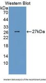 Signaling Lymphocytic Activation Molecule Family Member 1 / CD150 (SLAMF1) Antibody