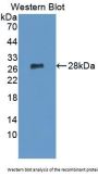 Integrin Alpha-L (ITGAL) Antibody