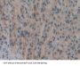 Docking Protein 7 (DOK7) Antibody