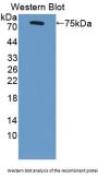 Scavenger Receptor Class B Member 1 Antibody