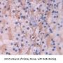 Scavenger Receptor Class B Member 1 Antibody