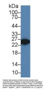 Dickkopf Like Protein 1 (DKKL1) Antibody