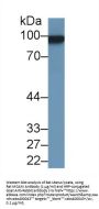 Melanoma Cell Adhesion Molecule (MCAM) Antibody