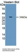Melanoma Cell Adhesion Molecule (MCAM) Antibody