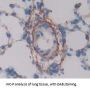 Melanoma Cell Adhesion Molecule (MCAM) Antibody