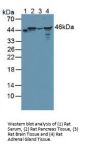 Branched Chain Alpha-Ketoacid Dehydrogenase Kinase (BCKDK) Antibody