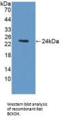 Branched Chain Alpha-Ketoacid Dehydrogenase Kinase (BCKDK) Antibody