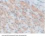 Branched Chain Alpha-Ketoacid Dehydrogenase Kinase (BCKDK) Antibody
