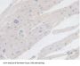 Branched Chain Alpha-Ketoacid Dehydrogenase Kinase (BCKDK) Antibody