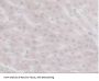 Branched Chain Alpha-Ketoacid Dehydrogenase Kinase (BCKDK) Antibody