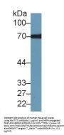 Transketolase Antibody