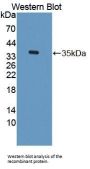 Transketolase Antibody