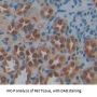 Transketolase Antibody
