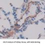 Vasoactive Intestinal Peptide Receptor 1 (VIPR1) Antibody