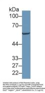 Protoporphyrinogen Oxidase (PPOX) Antibody