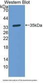 Protoporphyrinogen Oxidase (PPOX) Antibody