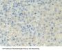 Protoporphyrinogen Oxidase (PPOX) Antibody