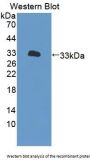 Period Circadian Protein 2 (PER2) Antibody