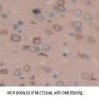 Echinoderm Microtubule Associated Protein Like Protein 2 (EML2) Antibody