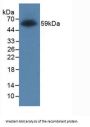 Glutathione S Transferase (GST) Antibody