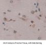 E2F Transcription Factor 2 (E2F2) Antibody