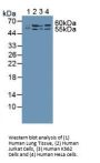 Malic Enzyme 2, NADP+ Dependent, Mitochondrial (ME2) Antibody