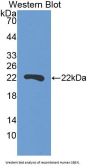 Suprabasin (SBSN) Antibody