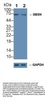 Suprabasin (SBSN) Antibody