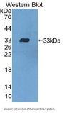 Dystrobrevin Beta (DTNb) Antibody